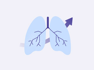 grafika dotycząca raportu „Jednoczasowa radiochemioterapia w leczeniu chorych na niedrobnokomórkowego, nieoperacyjnego raka płuca”